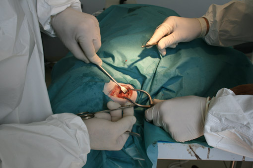 Chirurgie de la sphère ORL