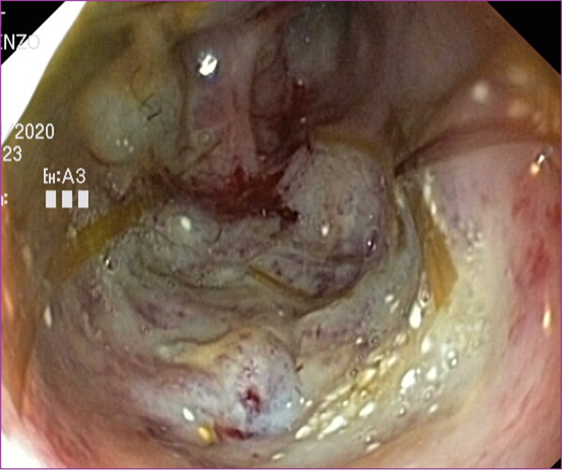 Formation ENDO-CF : Techniques d'endoscopie digestive et respiratoire