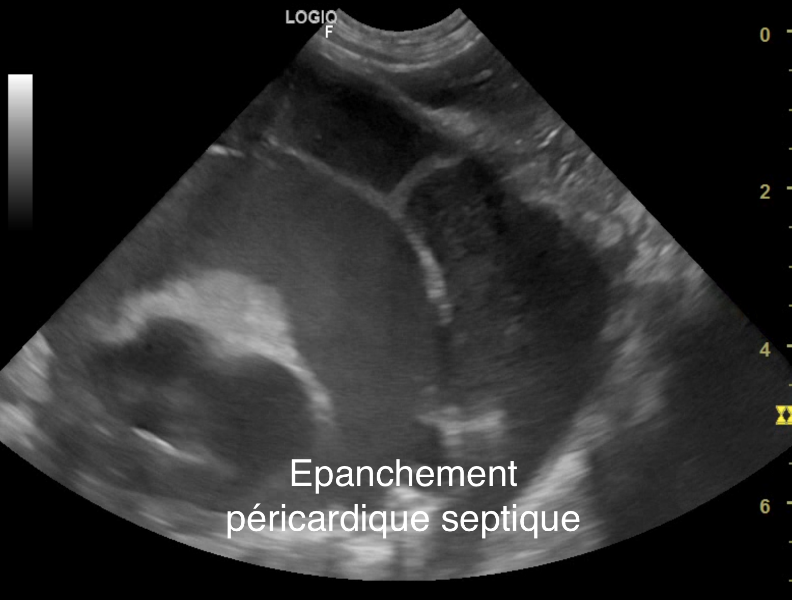 Formation ECHOFAST : Echographie en urgence (protocole F.A.S.T.)