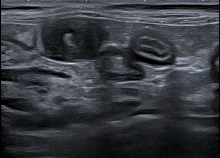 Formation CY-ABD-2 : Cycle en échographie abdominale canine et féline - Partie 2