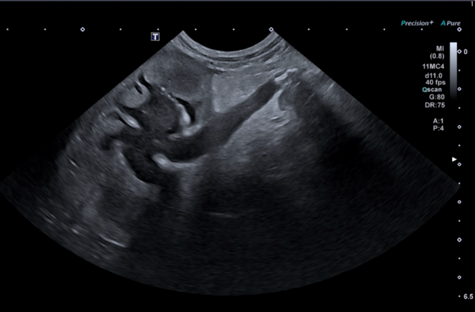 Formation EAP3 : Echographie abdominale pathologique : Tube digestif, pancréas et surrénales Formation EAP3 : Echographie abdominale pathologique : Tube digestif, pancréas et surrénales