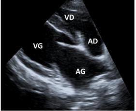 Formation EC001 : Echocardiographie : Modes BD et TM (Niveau 1)