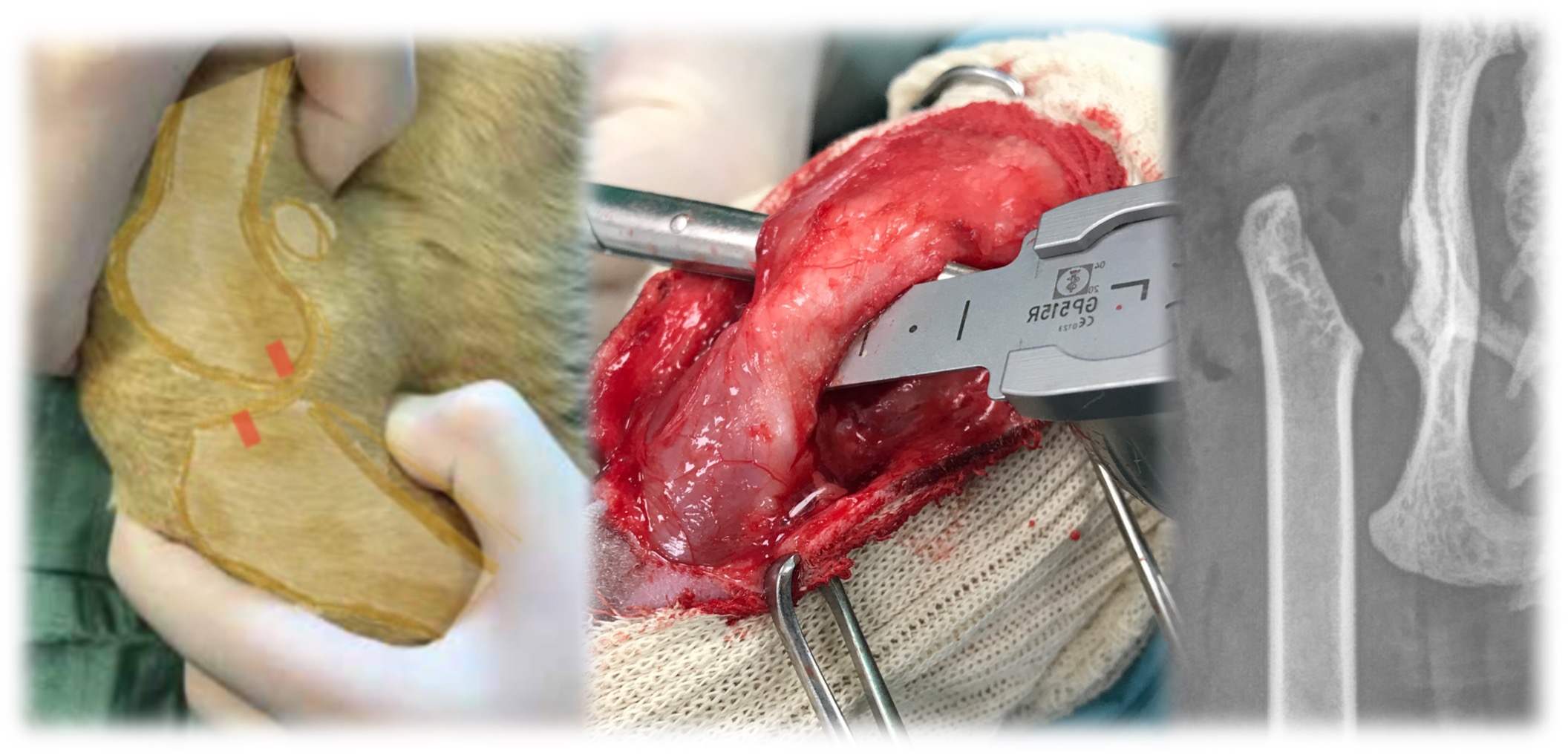 Formation CHIR2 : Chirurgie du grasset et de la hanche