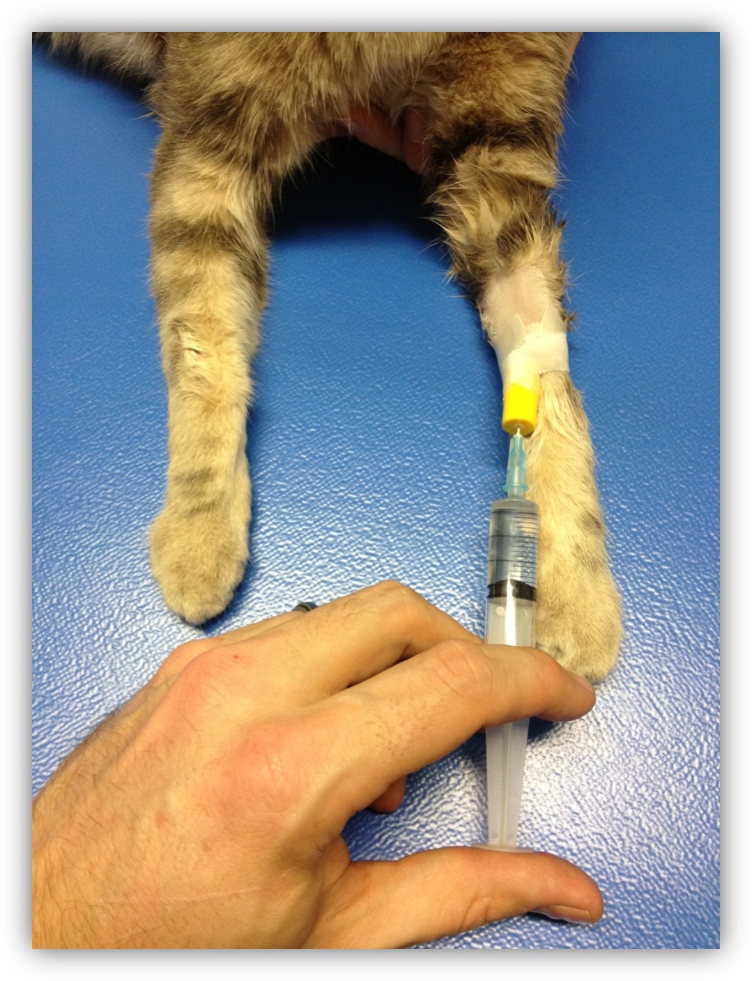 Formation CY-ATAN : Cycle d'anesthésie et analgésie au coeur de votre pratique Formation CY-ATAN : Cycle d'anesthésie et analgésie au coeur de votre pratique