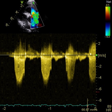 Formation CY-CAR : Cycle en cardiologie canine et féline : médecine et échocardiographie