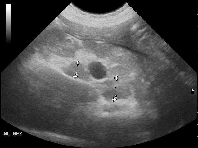 Formation CY-ABD2F : Cycle en échographie abdominale canine et féline