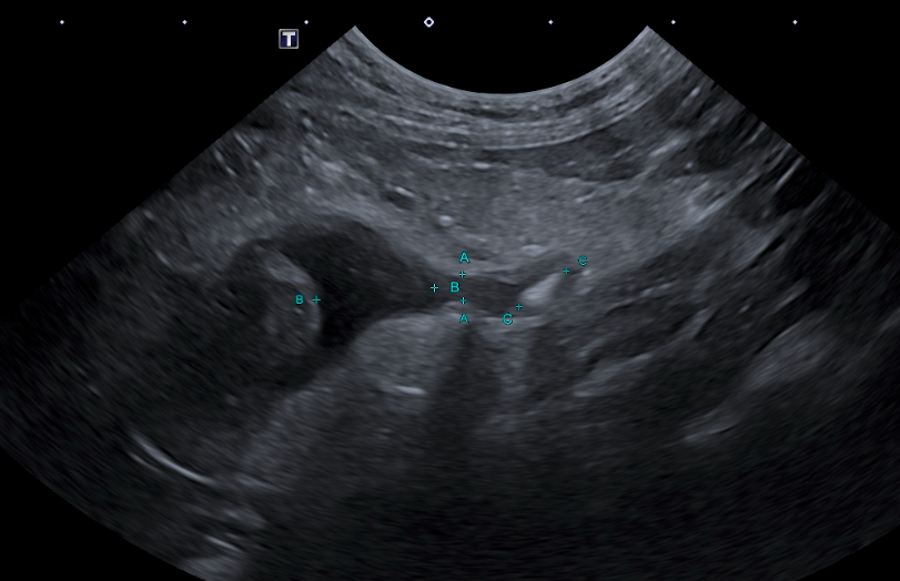 Formation CY-ABD-1 : Cycle en échographie abdominale canine et féline - Partie 1